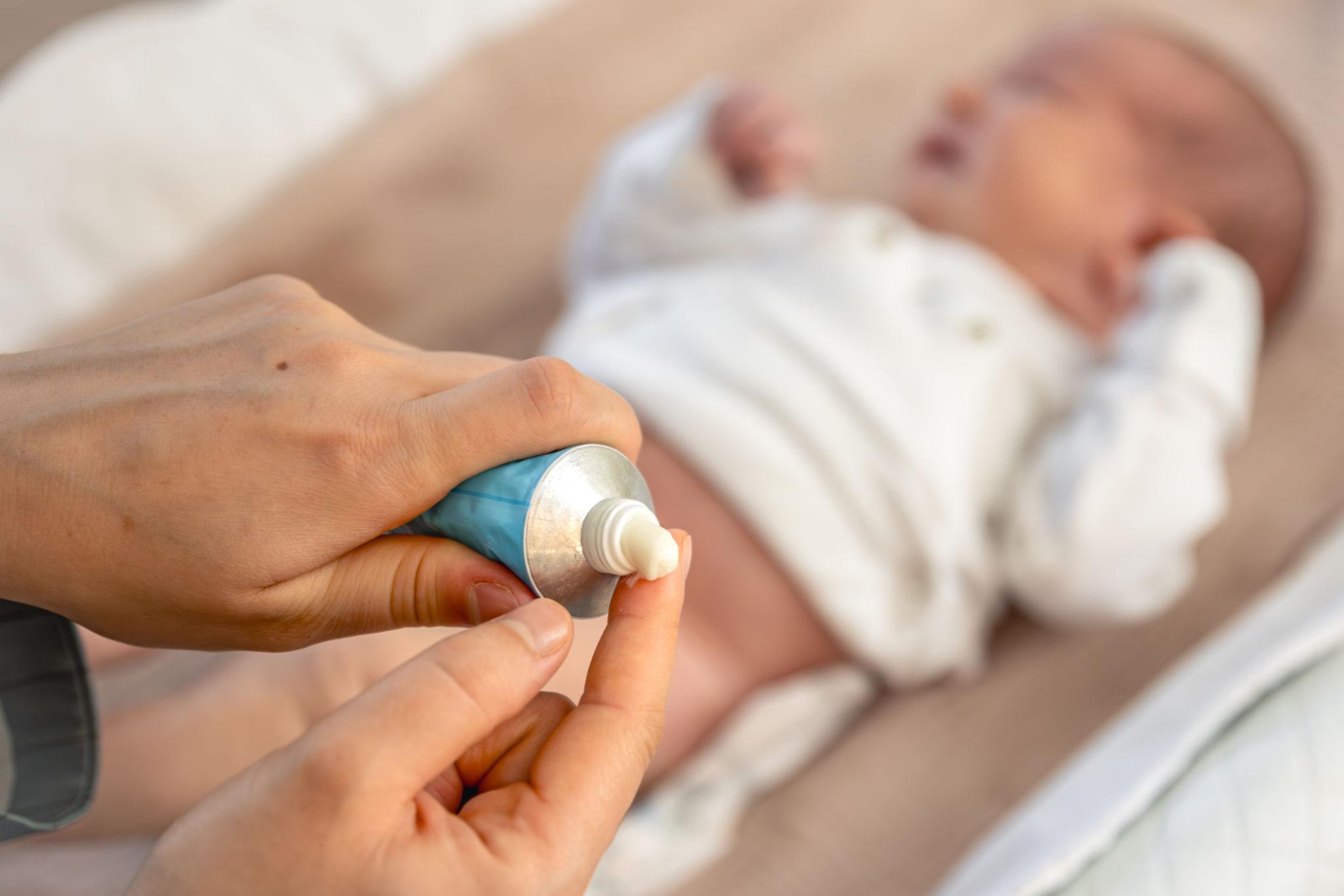 Applying diaper rash treatment cream to protect baby skin.